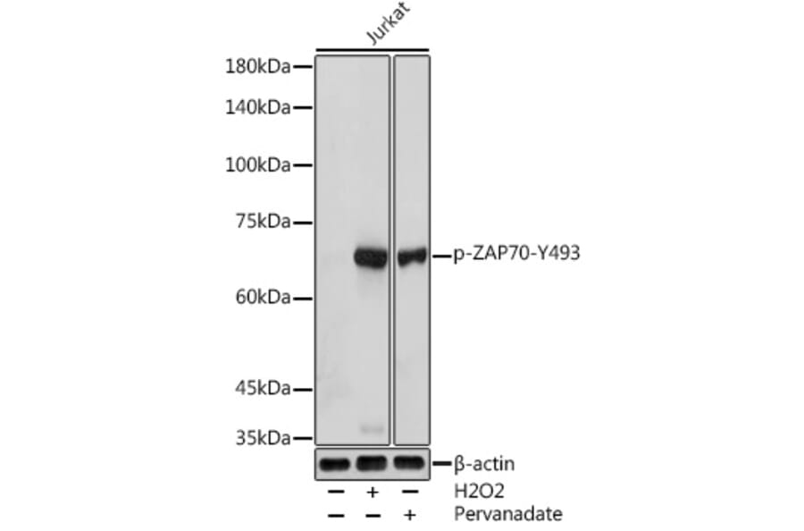 Western Blot - Anti-ZAP70 (phospho Tyr493) Antibody (A16675) - Antibodies.com