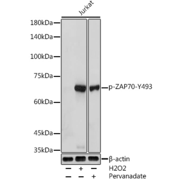 Western Blot - Anti-ZAP70 (phospho Tyr493) Antibody (A16675) - Antibodies.com