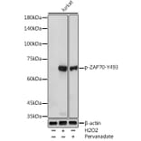 Western Blot - Anti-ZAP70 (phospho Tyr493) Antibody (A16675) - Antibodies.com