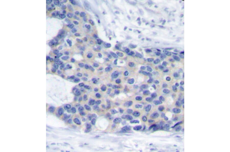 Immunohistochemistry - Anti-ZAP70 (phospho Tyr493) Antibody (A16675) - Antibodies.com
