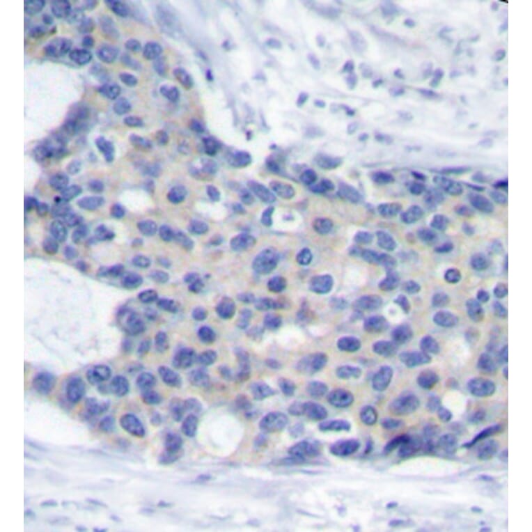 Immunohistochemistry - Anti-ZAP70 (phospho Tyr493) Antibody (A16675) - Antibodies.com