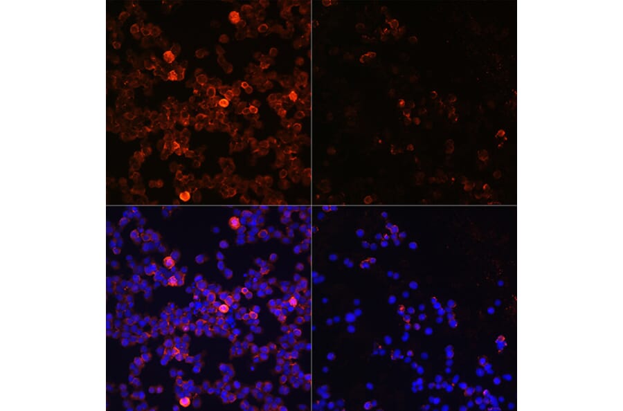 Immunofluorescence - Anti-ZAP70 (phospho Tyr493) Antibody (A16675) - Antibodies.com