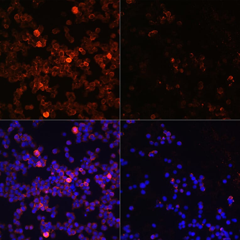 Immunofluorescence - Anti-ZAP70 (phospho Tyr493) Antibody (A16675) - Antibodies.com