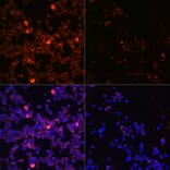 Immunofluorescence - Anti-ZAP70 (phospho Tyr493) Antibody (A16675) - Antibodies.com