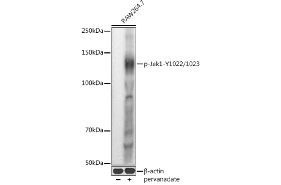 Western Blot - Anti-JAK1 (phospho Tyr1022 + Tyr1023) Antibody (A16681) - Antibodies.com