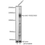 Western Blot - Anti-JAK1 (phospho Tyr1022 + Tyr1023) Antibody (A16681) - Antibodies.com