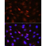 Immunofluorescence - Anti-JAK1 (phospho Tyr1022 + Tyr1023) Antibody (A16681) - Antibodies.com