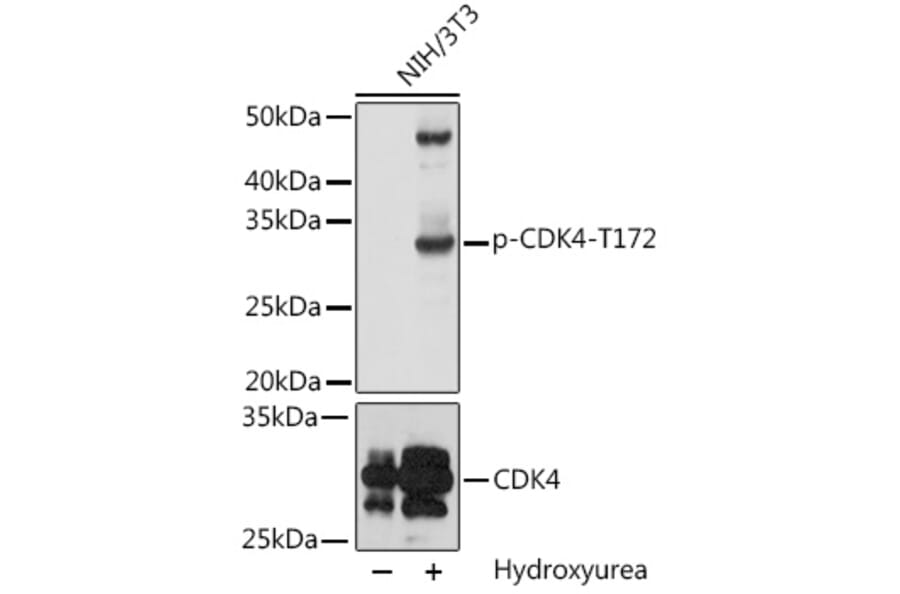 Western Blot - Anti-Cdk4 (phospho Thr172) Antibody (A16682) - Antibodies.com