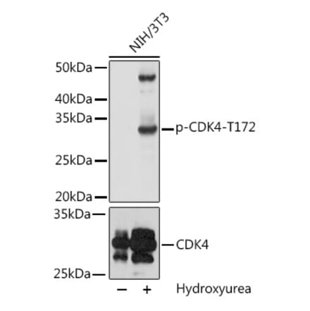 Western Blot - Anti-Cdk4 (phospho Thr172) Antibody (A16682) - Antibodies.com