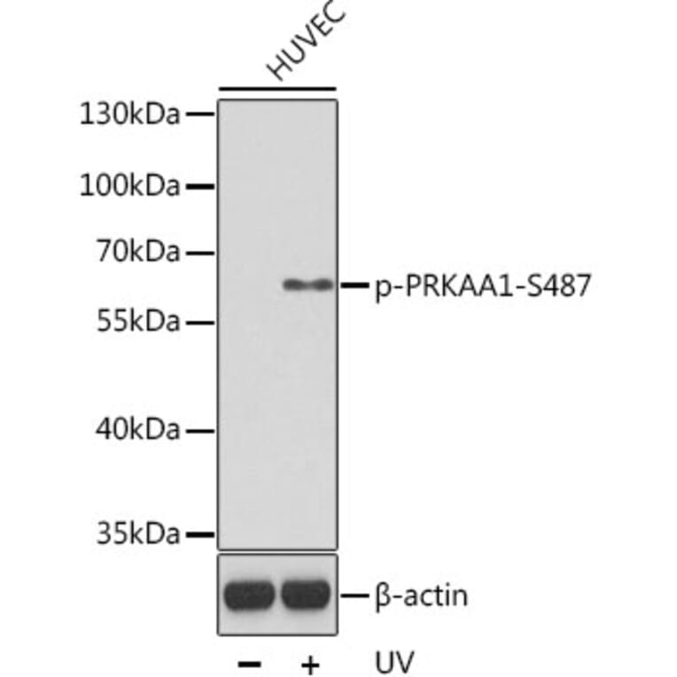 Western Blot - Anti-PRKAA1 (phospho S496) Antibody (AP0619) - Antibodies.com
