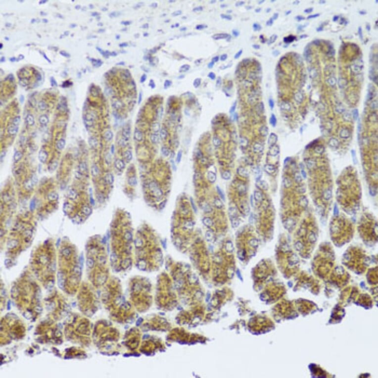 Immunohistochemistry - Anti-TrkA Antibody (A16686) - Antibodies.com
