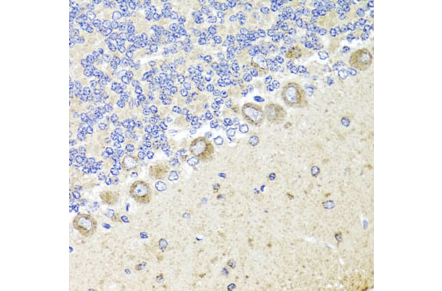 Immunohistochemistry - Anti-TrkA Antibody (A16686) - Antibodies.com