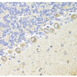 Immunohistochemistry - Anti-TrkA Antibody (A16686) - Antibodies.com