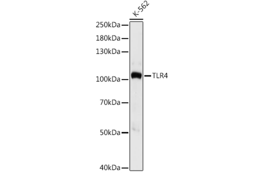 Western Blot - Anti-TLR4 Antibody (A16687) - Antibodies.com