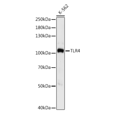 Western Blot - Anti-TLR4 Antibody (A16687) - Antibodies.com