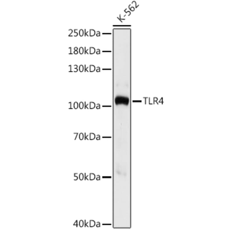 Western Blot - Anti-TLR4 Antibody (A16687) - Antibodies.com