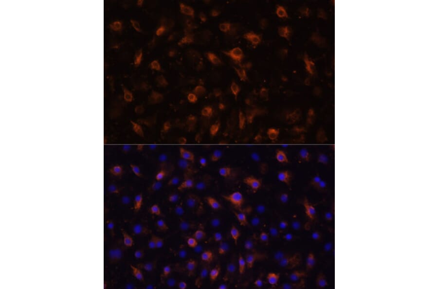 Immunofluorescence - Anti-TLR4 Antibody (A16687) - Antibodies.com
