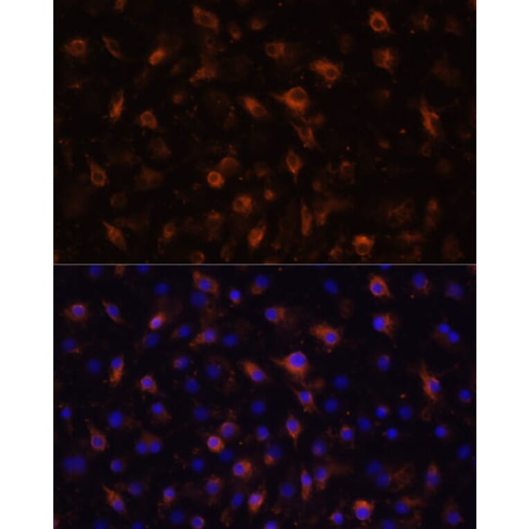 Immunofluorescence - Anti-TLR4 Antibody (A16687) - Antibodies.com