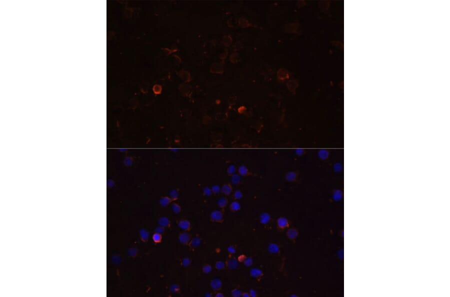 Immunofluorescence - Anti-TLR4 Antibody (A16687) - Antibodies.com
