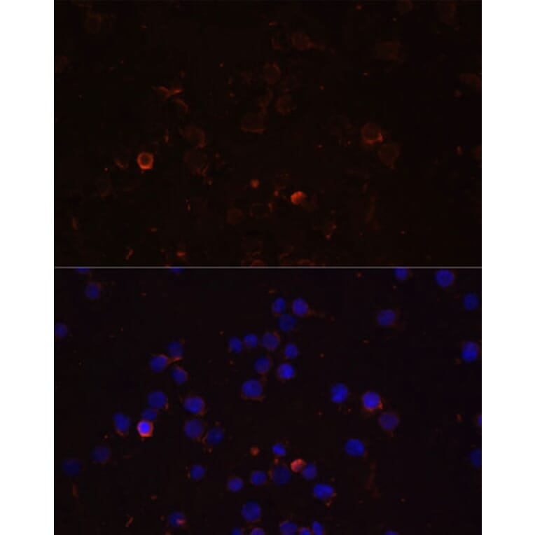 Immunofluorescence - Anti-TLR4 Antibody (A16687) - Antibodies.com