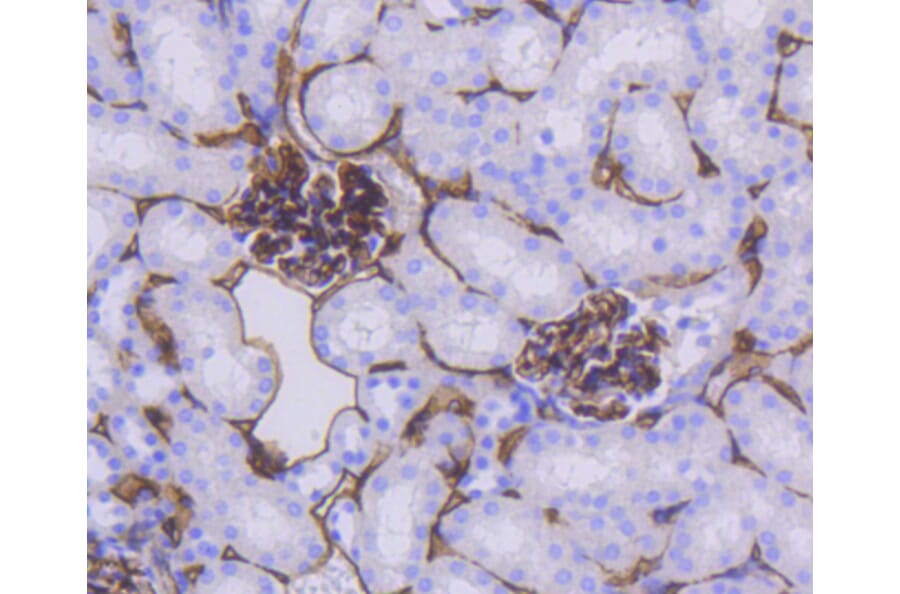 Immunohistochemistry - Anti-CD34 Antibody (A10796) - Antibodies.com