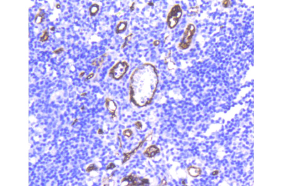 Immunohistochemistry - Anti-CD34 Antibody (A10796) - Antibodies.com