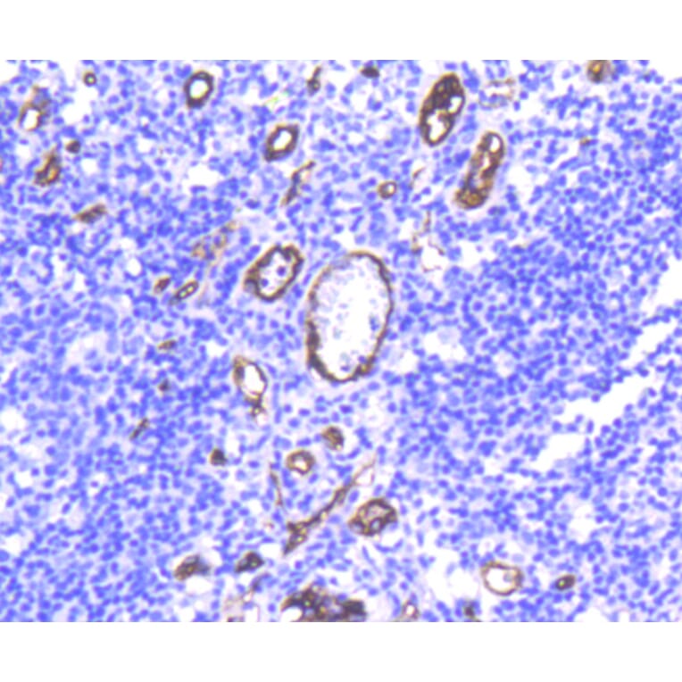 Immunohistochemistry - Anti-CD34 Antibody (A10796) - Antibodies.com