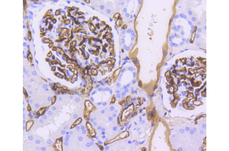 Immunohistochemistry - Anti-CD34 Antibody (A10796) - Antibodies.com