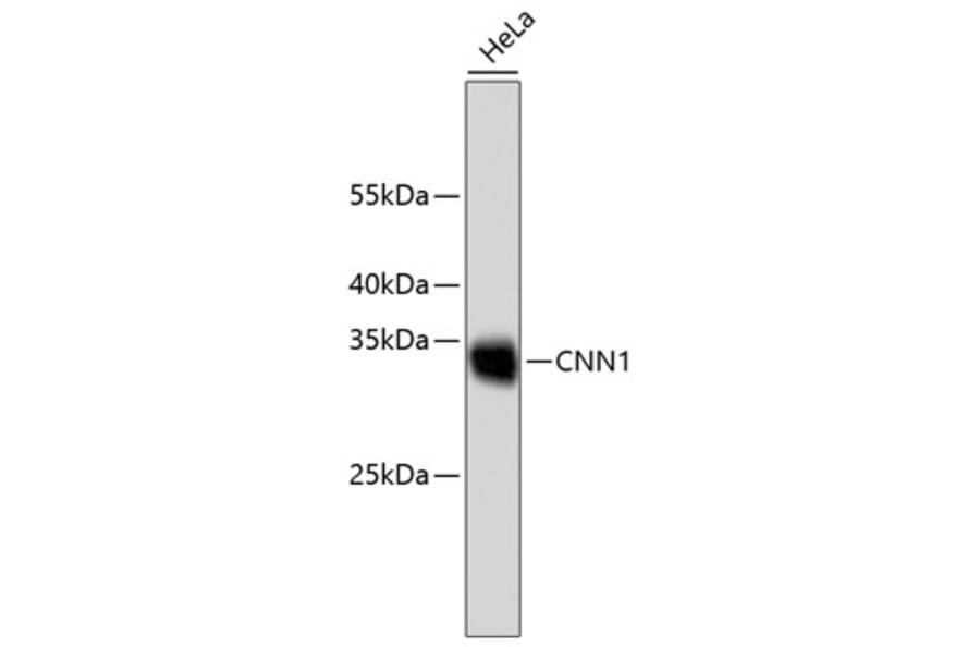 Western Blot - Anti-CNN1 Antibody (A10822) - Antibodies.com