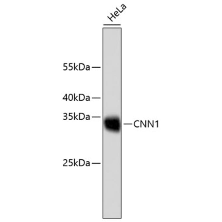 Western Blot - Anti-CNN1 Antibody (A10822) - Antibodies.com