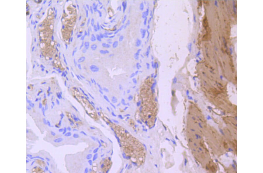 Immunohistochemistry - Anti-CNN1 Antibody (A10822) - Antibodies.com