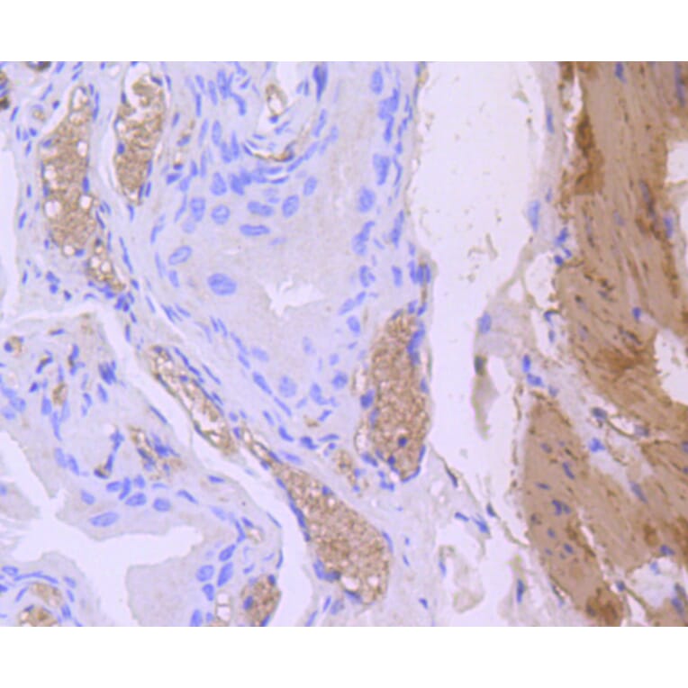 Immunohistochemistry - Anti-CNN1 Antibody (A10822) - Antibodies.com