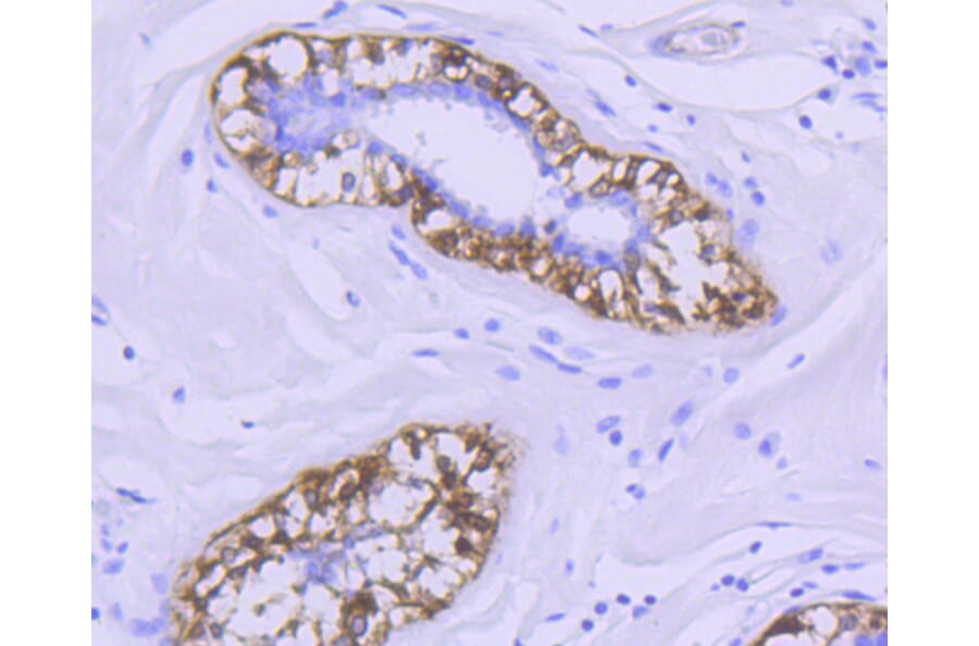 Immunohistochemistry - Anti-CNN1 Antibody (A10822) - Antibodies.com