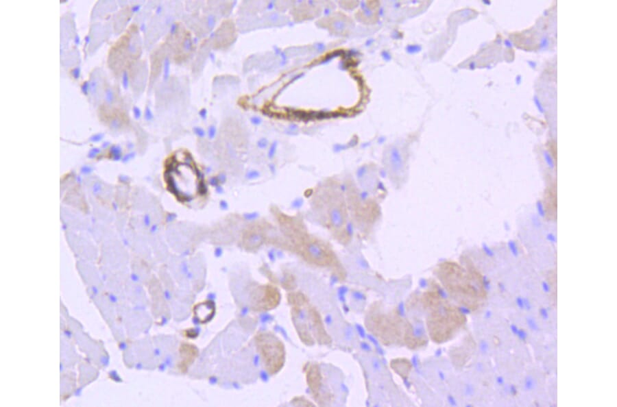 Immunohistochemistry - Anti-CNN1 Antibody (A10822) - Antibodies.com