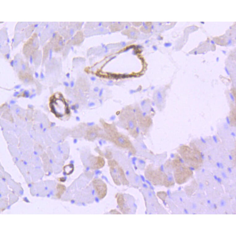 Immunohistochemistry - Anti-CNN1 Antibody (A10822) - Antibodies.com