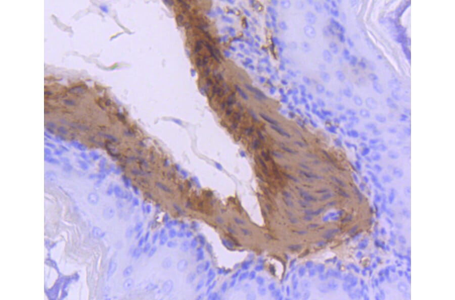 Immunohistochemistry - Anti-CNN1 Antibody (A10822) - Antibodies.com