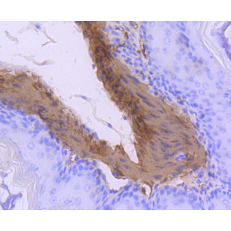 Immunohistochemistry - Anti-CNN1 Antibody (A10822) - Antibodies.com