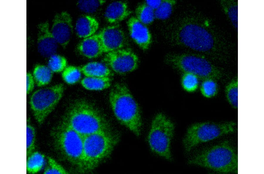 Immunofluorescence - Anti-CNN1 Antibody (A10822) - Antibodies.com
