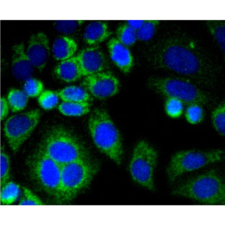 Immunofluorescence - Anti-CNN1 Antibody (A10822) - Antibodies.com