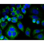 Immunofluorescence - Anti-CNN1 Antibody (A10822) - Antibodies.com