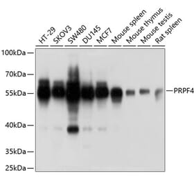 Western Blot - Anti-PRPF4 Antibody (A6052) - Antibodies.com