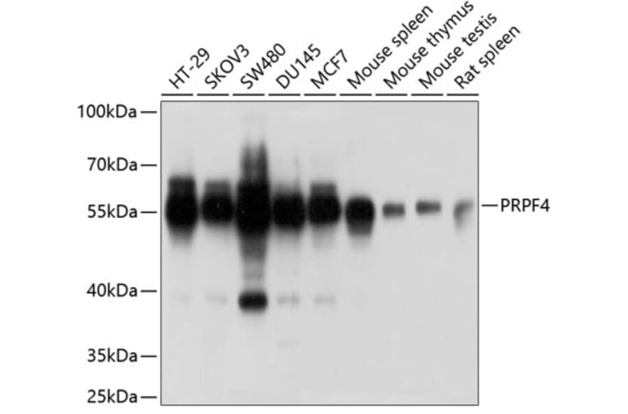 Western Blot - Anti-PRPF4 Antibody (A6052) - Antibodies.com