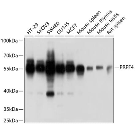 Western Blot - Anti-PRPF4 Antibody (A6052) - Antibodies.com