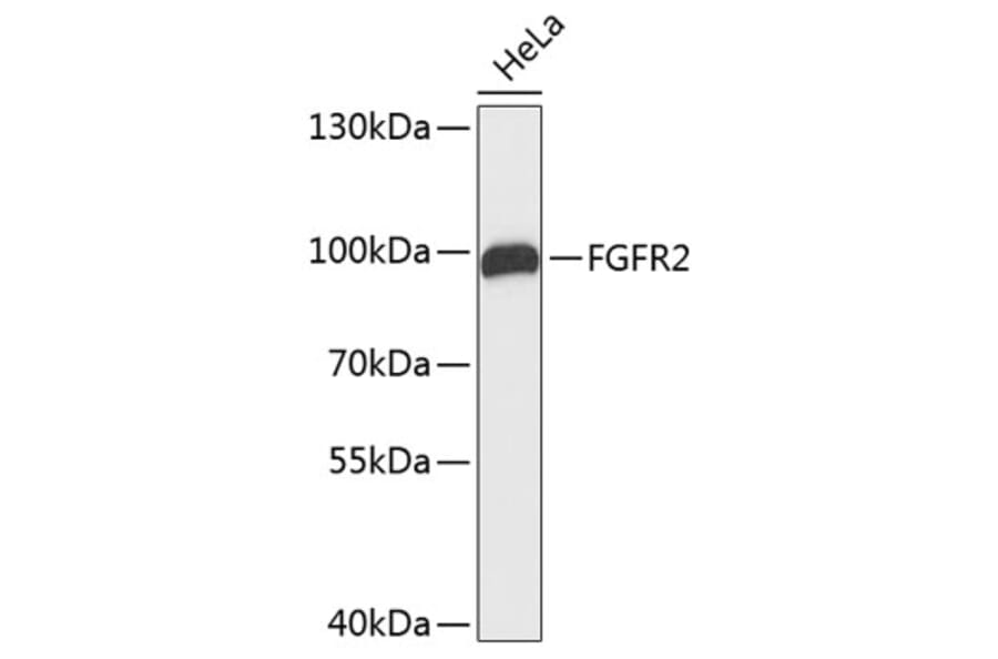 Western Blot - Anti-FGFR2 Antibody (A0044) - Antibodies.com