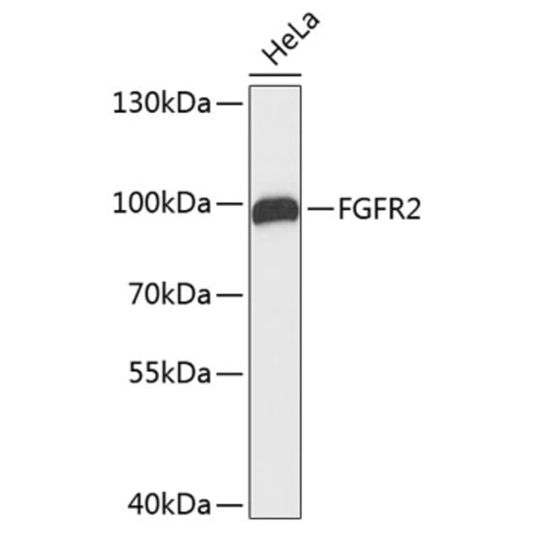 Western Blot - Anti-FGFR2 Antibody (A0044) - Antibodies.com