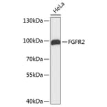 Western Blot - Anti-FGFR2 Antibody (A0044) - Antibodies.com