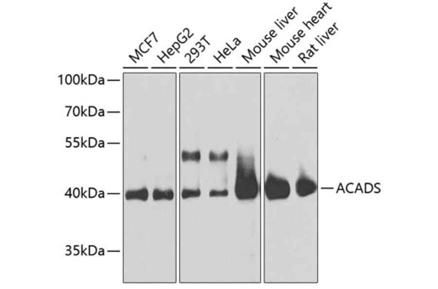 Western Blot - Anti-ACADS/SCAD Antibody (A16694) - Antibodies.com