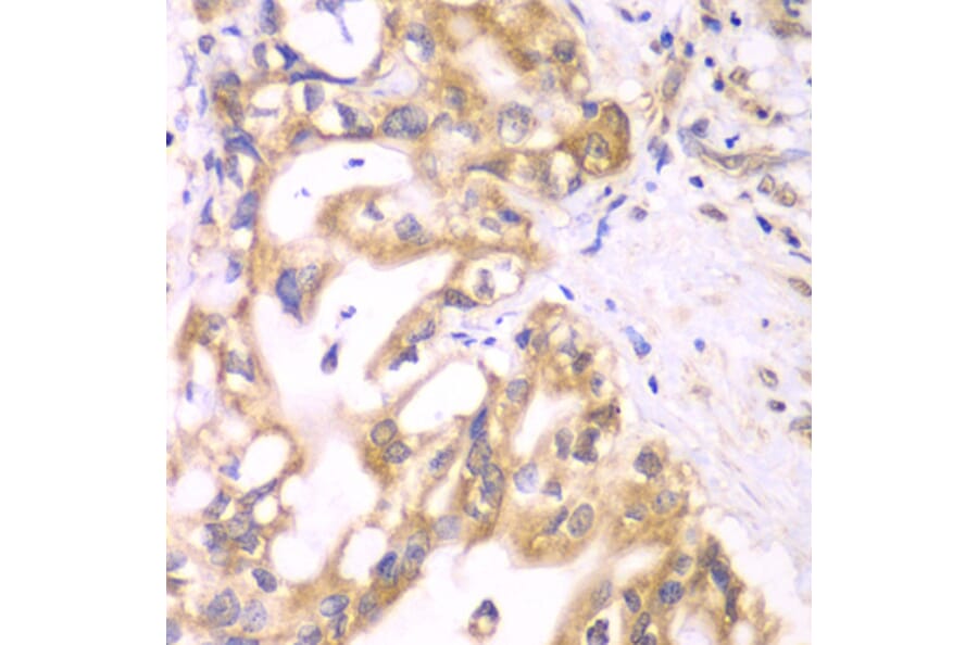 Immunohistochemistry - Anti-ACADS/SCAD Antibody (A16694) - Antibodies.com