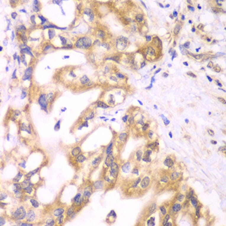Immunohistochemistry - Anti-ACADS/SCAD Antibody (A16694) - Antibodies.com