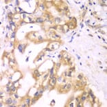 Immunohistochemistry - Anti-ACADS/SCAD Antibody (A16694) - Antibodies.com